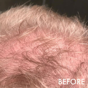 Hairloss Control Shampoo
